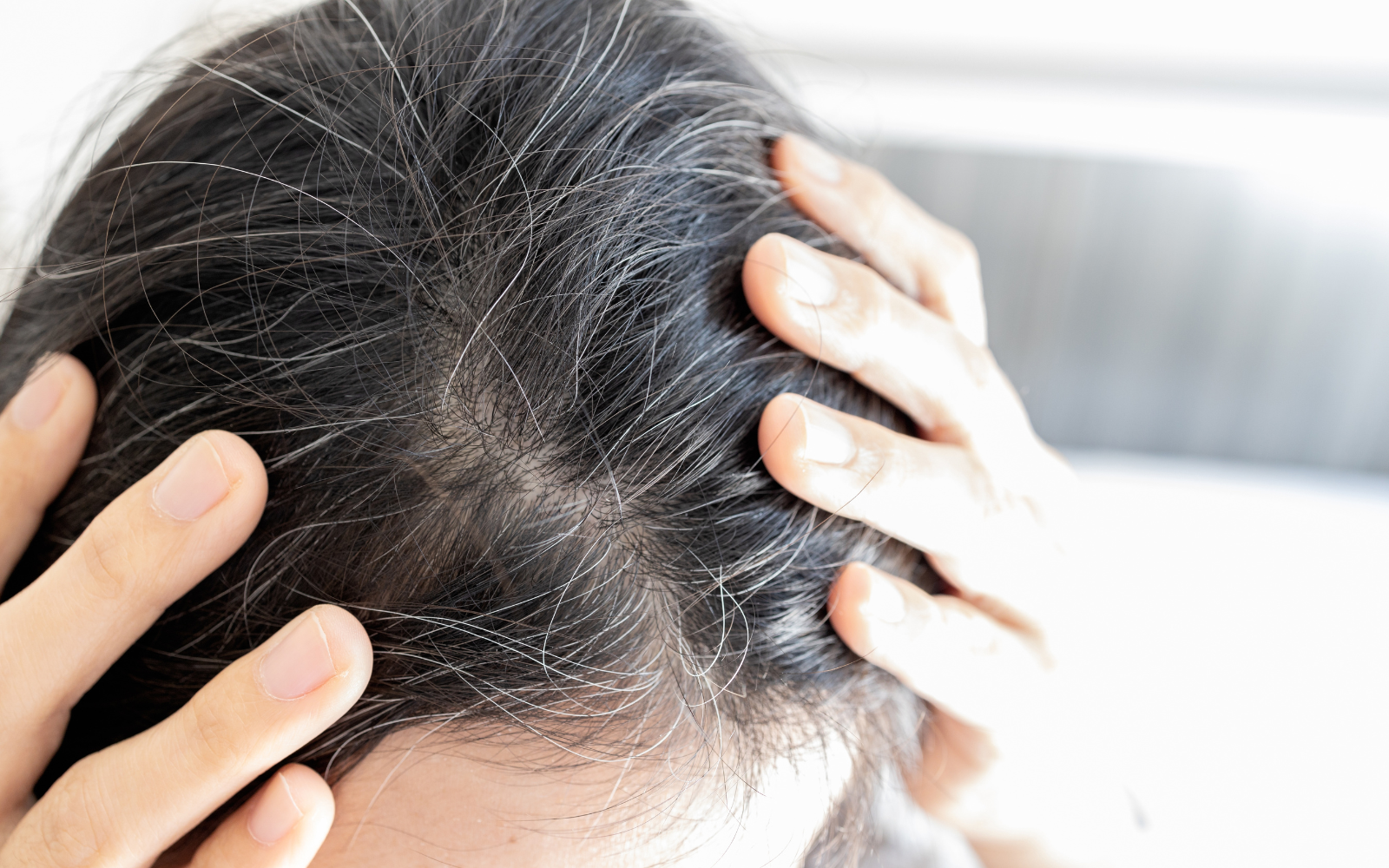 First signs of graying hair. Oxford Healthspan